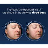 PCA Skin Blemish Control Bar