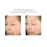 PCA Skin Hyaluronic Acid Boosting Serum