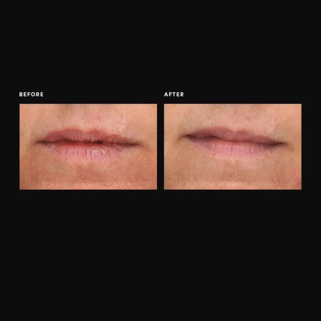 PCA Skin Overnight lip Mask
