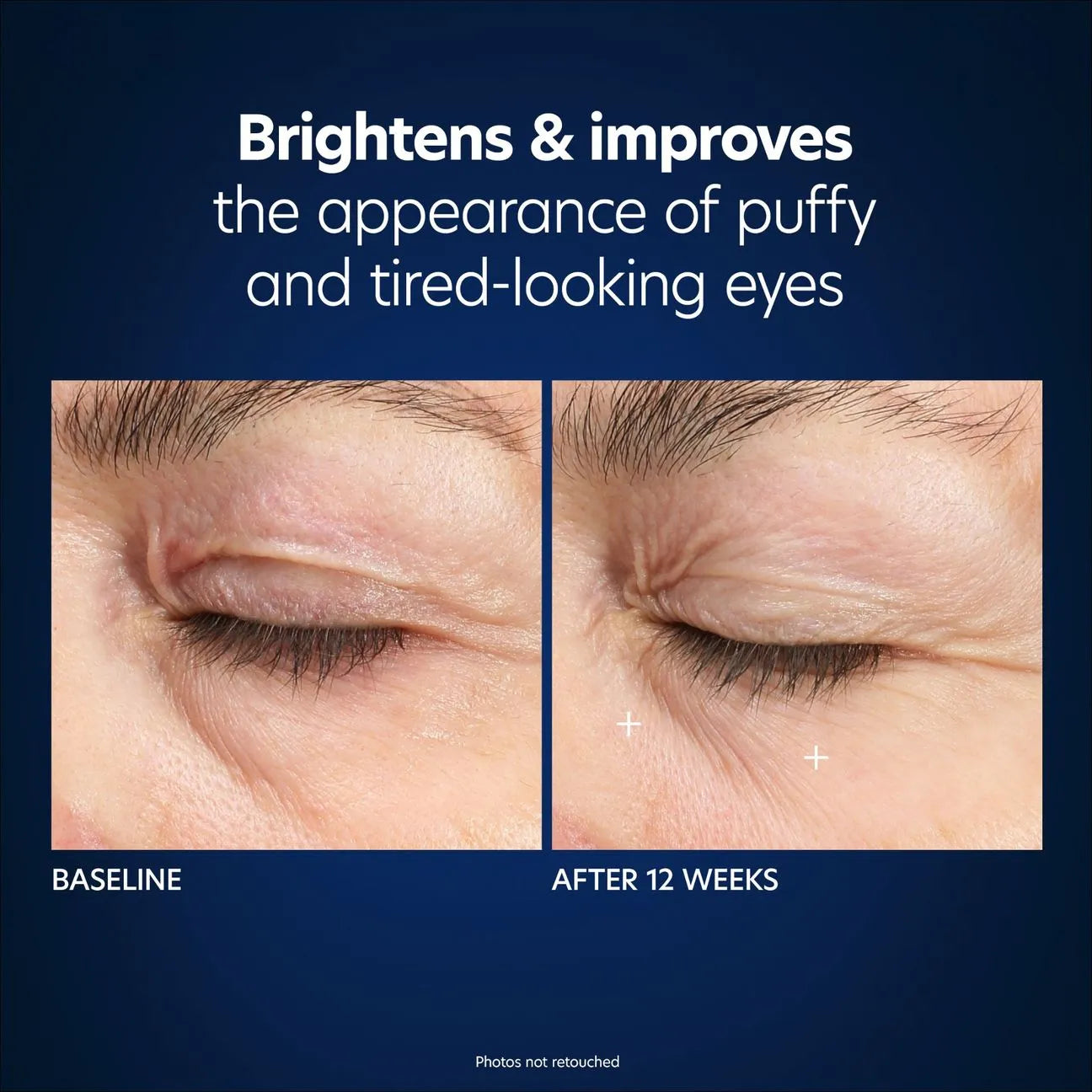 PCA Skin Hyaluronic Acid Boosting Serum