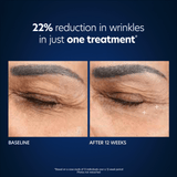 PCA Skin Hyaluronic Acid Boosting Serum