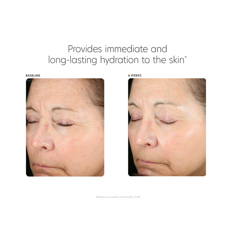 PCA Skin Hyaluronic Acid Boosting Serum