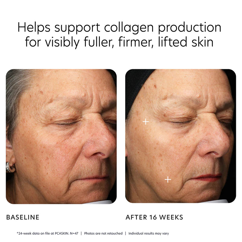 PCA MGF age renewal cream